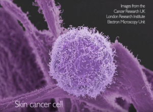 skin cancer cell